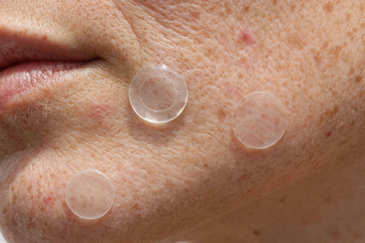 Invisible Pimple Patches — Hydrocolloid